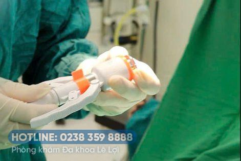 Biện pháp chống xuất tinh sớm cho nam giới