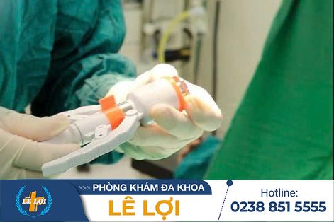 Biện pháp chống xuất tinh sớm cho nam giới