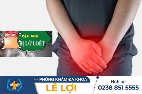 Dương vật lở loét nguy hiểm ra sao – Phương pháp điều trị hiệu quả nhất hiện nay