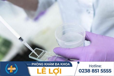 Chi Phí Xét Nghiệm Tinh Trùng Là Bao Nhiêu – Bảng Giá Mới Nhất
