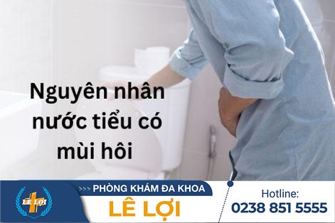 Nước tiểu có mùi hôi: Dấu hiệu bình thường hay cảnh báo bệnh lý?