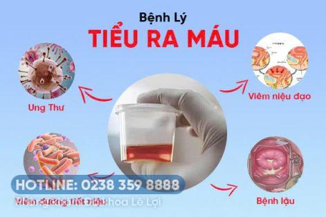 Nguy hiểm của tiểu ra máu mà nam giới cần đặc biệt lưu ý