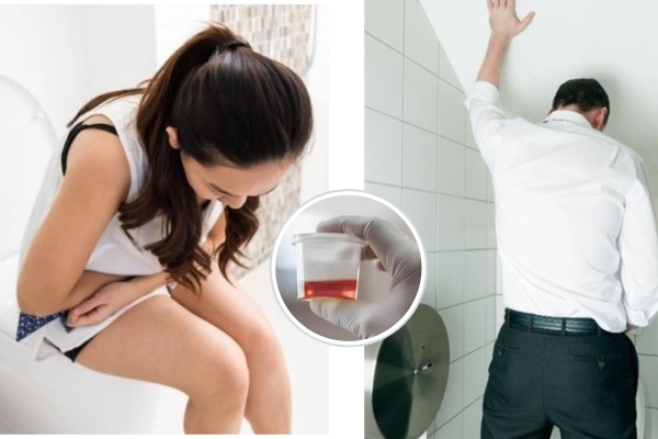 Tiểu buốt ra máu nguy hiểm hay không?