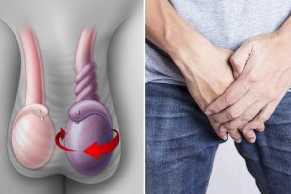 Chủ quan với bệnh tinh hoàn: Nhiều người lãnh hậu quả!