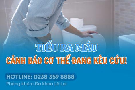 Đi tiểu buốt ra máu – Cảnh báo cơ thể đang “kêu cứu”