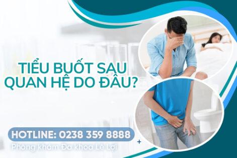 Tiểu Buốt Sau Khi Quan Hệ – Dấu Hiệu Bệnh Nguy Hiểm Không Nên Bỏ Qua